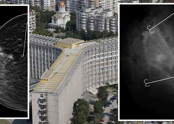 interventie spitalul judetean