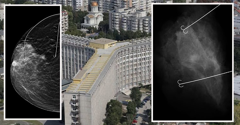 interventie spitalul judetean