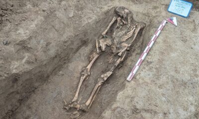 muzeu spital municipal