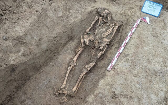 muzeu spital municipal